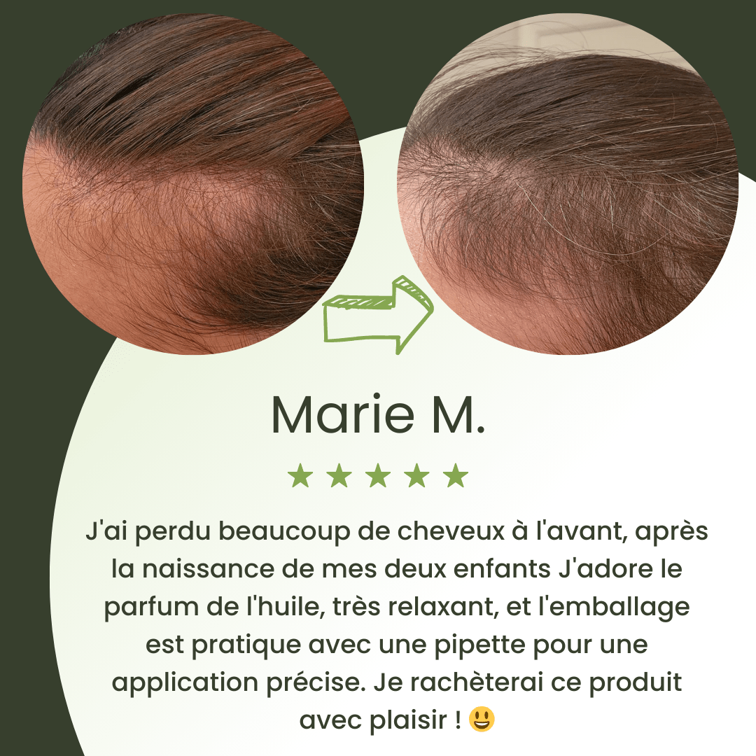 Sérum de croissance pour cheveux (60ml)