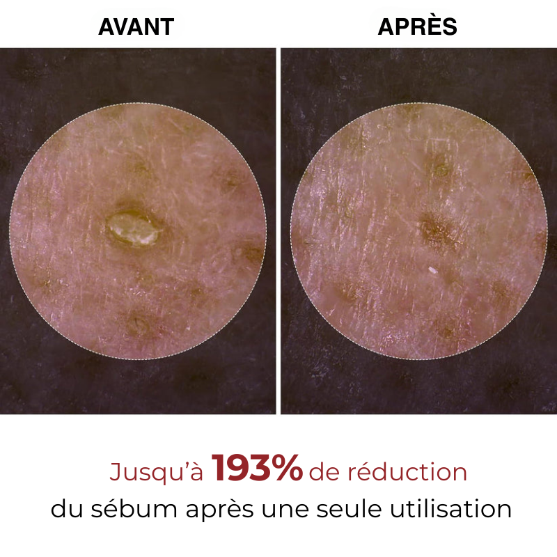 Dermiqo™ Duo Exfoliant au Riz – Lisse, Illumine & Rafraîchit Instantanément Votre Peau