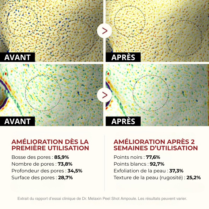 Dermiqo™ Duo Exfoliant au Riz – Lisse, Illumine & Rafraîchit Instantanément Votre Peau