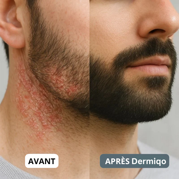 SensiCalma® Duo+ ⎜ Barbe et cuir chevelu apaisés